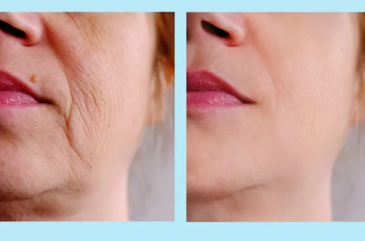 Anti-Aging