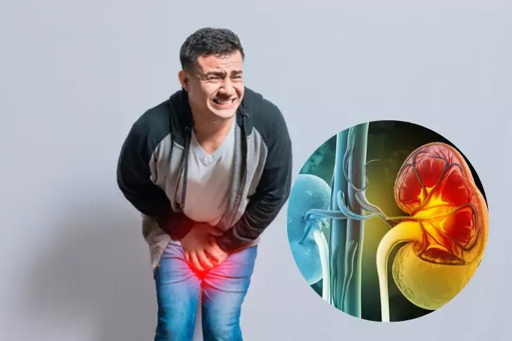 Kidney & Urinary Disorders