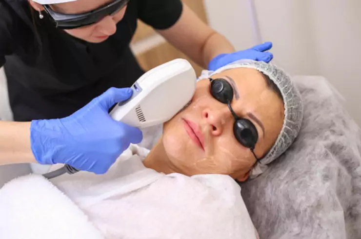 Photofacial