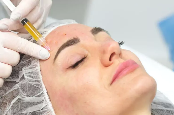 PRP Treatment